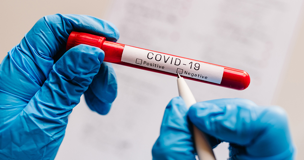 HR Law Update: Arbitrator Upholds Covid-19 On-Site Testing Policy